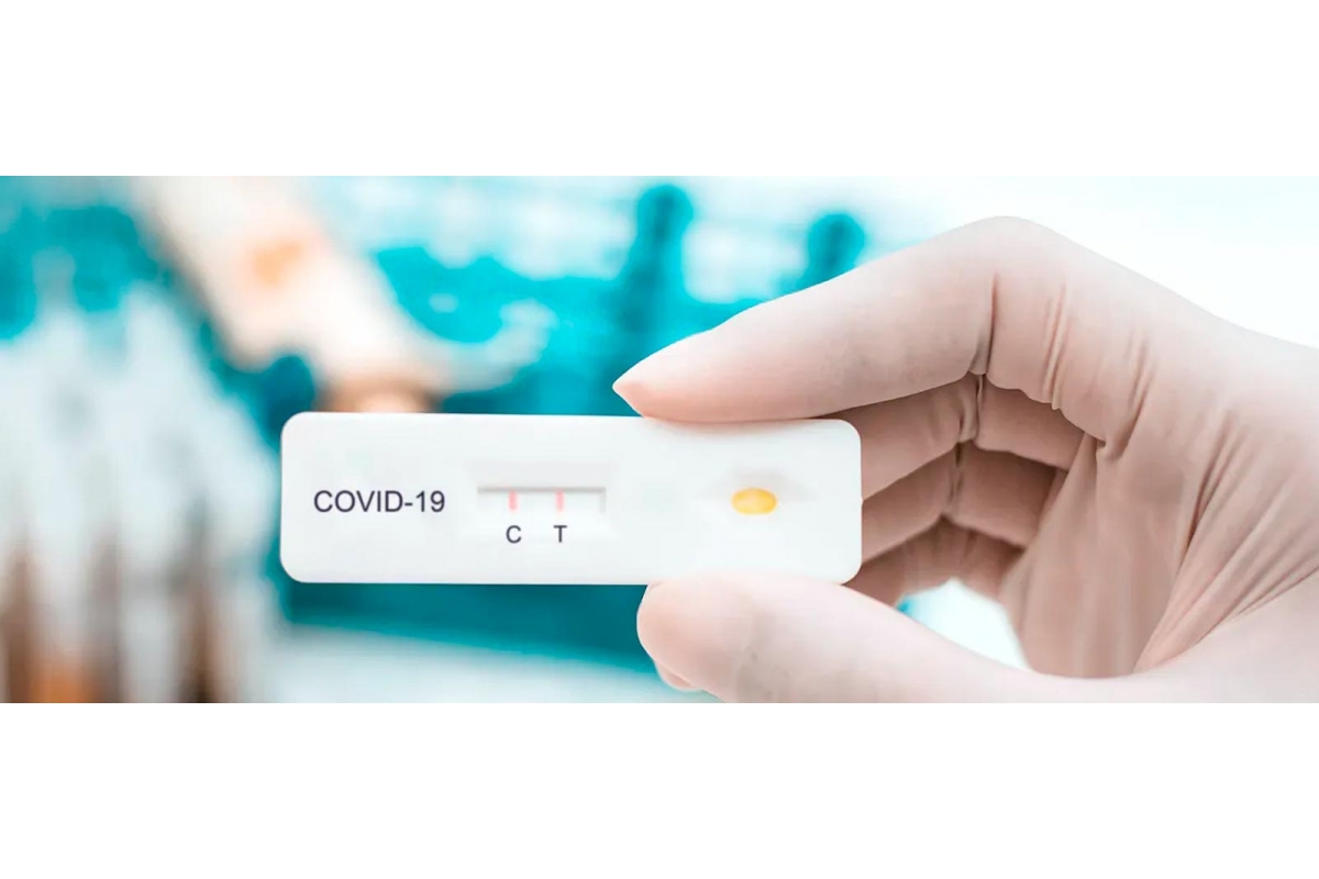 Novedad en la farmacia: test rápidos y sin receta que detectan antígenos de la COVID